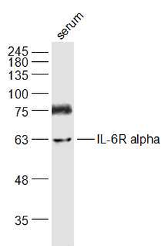 IL-6R alpha Rabbit Polyclonal Antibody