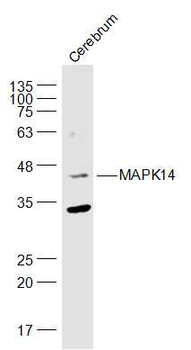 P38 MAPK/ MAPK14 Rabbit Polyclonal Antibody