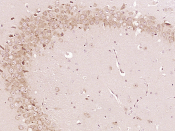 PER2 Rabbit Polyclonal Antibody