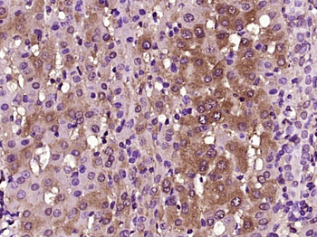 HO-1 Rabbit Polyclonal Antibody