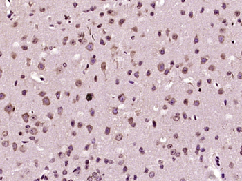 SCLT1 Rabbit Polyclonal Antibody