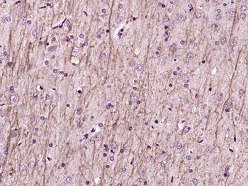 NMDAR1 Rabbit Polyclonal Antibody