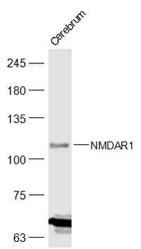 NMDAR1 Rabbit Polyclonal Antibody