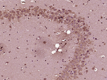 MCFD2 Rabbit Polyclonal Antibody