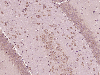MCFD2 Rabbit Polyclonal Antibody