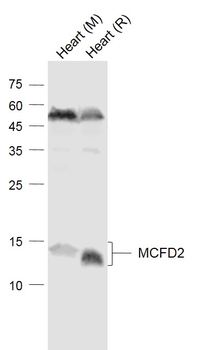 MCFD2 Rabbit Polyclonal Antibody