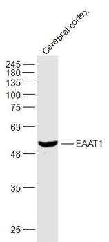 EAAT1 Rabbit Polyclonal Antibody