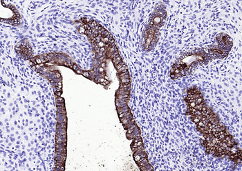 CK16 Mouse Monoclonal Antibody