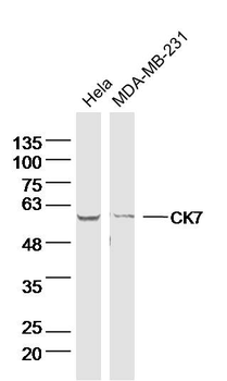 CK7 Mouse Monoclonal Antibody