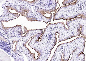 CK7 Mouse Monoclonal Antibody