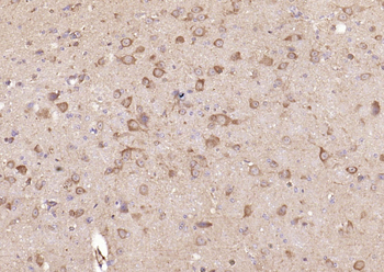 GSK-3 Beta Mouse Monoclonal Antibody