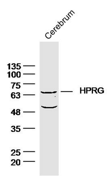 IL-1R1 Rabbit Polyclonal Antibody