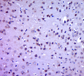 SOD2 Rabbit Polyclonal Antibody
