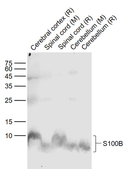 S100B Mouse Monoclonal Antibody