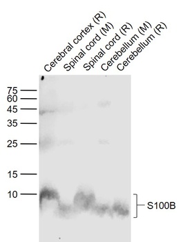 S100B antibody