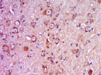 ITSN2 Rabbit Polyclonal Antibody