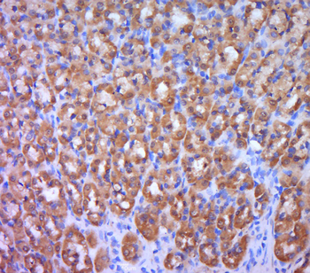 ITSN2 Rabbit Polyclonal Antibody