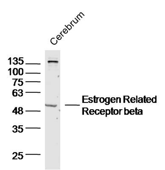Estrogen Related Receptor beta Rabbit Polyclonal Antibody