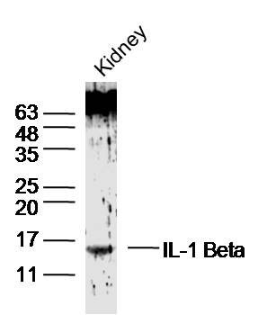 IL-1 Beta Rabbit Polyclonal Antibody