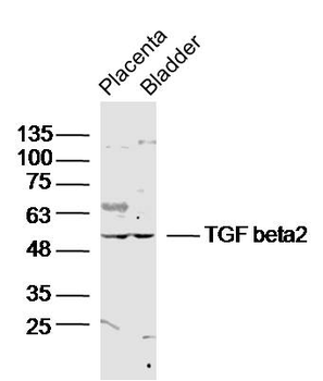 TGF beta 2 Rabbit Polyclonal Antibody
