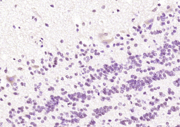 Somatostatin 14 Rabbit Polyclonal Antibody