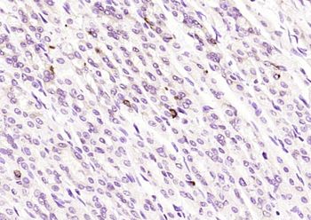 Somatostatin 14 Rabbit Polyclonal Antibody