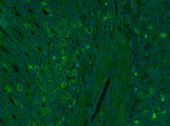 Somatostatin 14 Rabbit Polyclonal Antibody