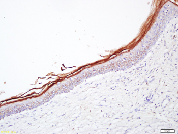 Filaggrin Rabbit Polyclonal Antibody