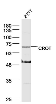CROT Rabbit Polyclonal Antibody
