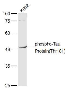 Phospho-Tau Protein (Thr181) Rabbit Polyclonal Antibody