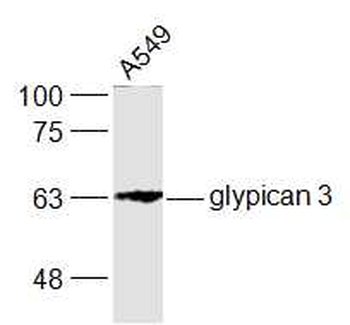 Glypican 3 Rabbit Polyclonal Antibody
