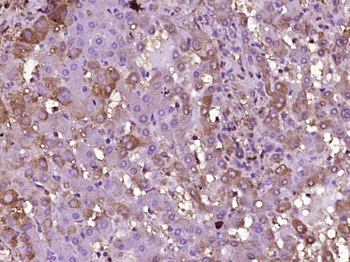 TREM1 Rabbit Polyclonal Antibody