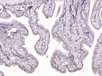 Cytokeratin 19 Mouse Monoclonal Antibody