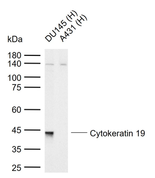 Cytokeratin 19 Mouse Monoclonal Antibody