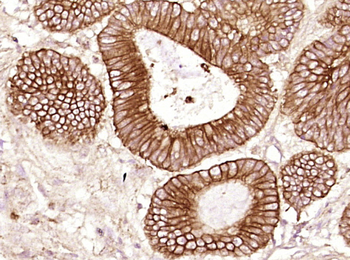 Cytokeratin 19 Mouse Monoclonal Antibody