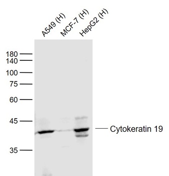 Cytokeratin 19 antibody