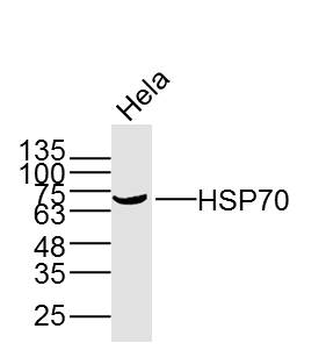 HSP70 Mouse Monoclonal Antibody