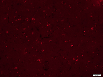 EGFR Mouse Monoclonal Antibody