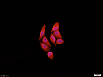 EGFR Mouse Monoclonal Antibody