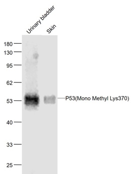 p53 P53(Mono Methyl Lys370) antibody