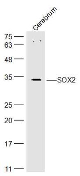 SOX2 antibody