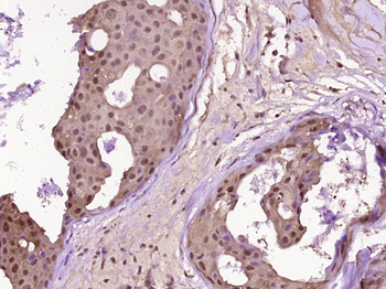 PARP1 Rabbit Polyclonal Antibody
