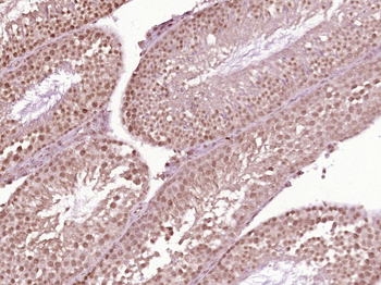 AR/Androgen receptor Rabbit Polyclonal Antibody