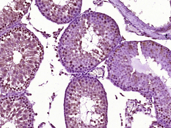 AR/Androgen receptor Rabbit Polyclonal Antibody