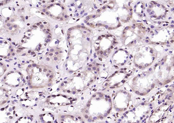 HIF-1 Alpha Rabbit Polyclonal Antibody