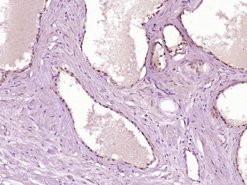 DLX2 Rabbit Polyclonal Antibody