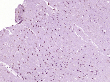 DLX2 Rabbit Polyclonal Antibody