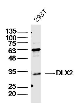 DLX2 Rabbit Polyclonal Antibody