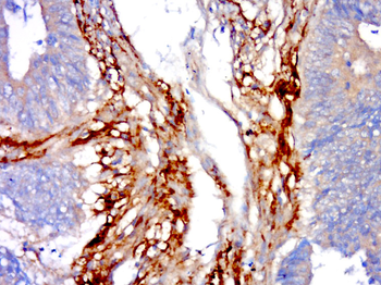 CHSS2 Rabbit Polyclonal Antibody