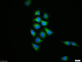 EGFRvIII Rabbit Polyclonal Antibody